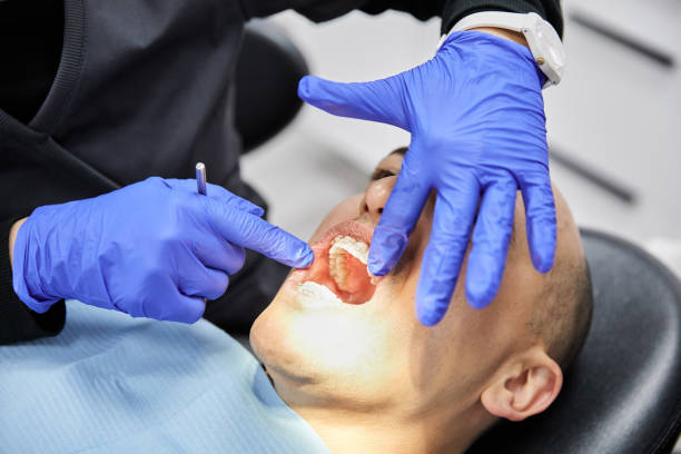 Dentist for Dental Trauma in FL